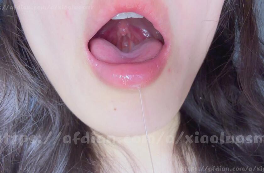 小鹿大困包 喉咙.